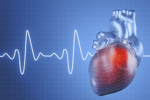 Làm thế nào để thoát khỏi chứng loạn nhịp tim