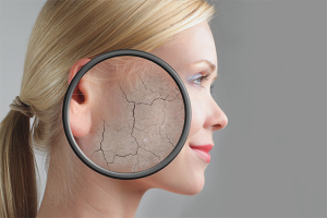Kako se riješiti ljuštenja kože na licu