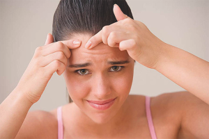 Hoe interne acne te verwijderen