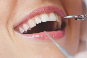 Com desfer-se de la malaltia periodontal