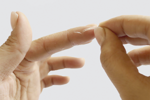 วิธีการลบ superglue จากนิ้วมือ